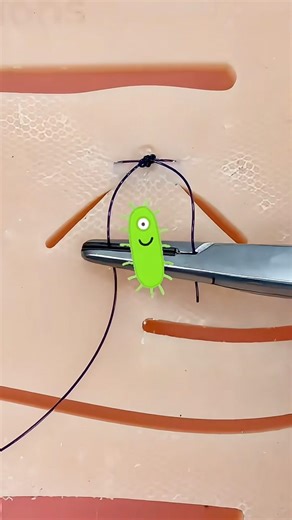 Infected Stitches 😷🦠 #goodtoknow #surgeonlife #suturing #stitches #funfacts #lifehacks #survival