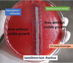 Satellitism test for the identification of Haemophilus influenzae: Introduction