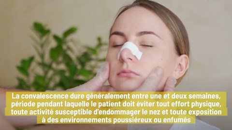 Chirurgie De La Déviation De La Cloison Nasale : Quand Est-Elle Vraiment Nécessaire ?
