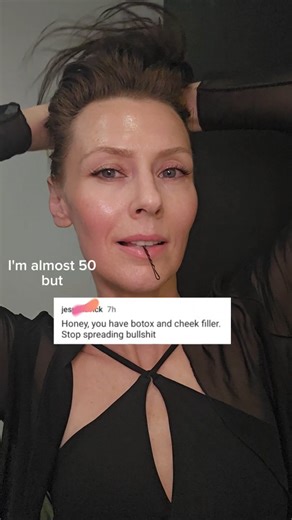 Natural Face Bible |Face Taping |Skincare on Instagram: "Can't believe there are still some people out there who think Botox is the only solution 🫣 If I ever wanted to get fillers, I would fill my hollowing temples as that will make my face more youthful and well balanced but I don't 🙄 clearly as know way too much how poorly fillers affect our tissues wellness and aging process. But, we all learn something new every day and if you are not into Botox anymore, you are welcome to give a try to JA