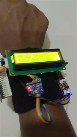 IoT Based Wearable Health Monitoring and Sleep Tracking System Using ESP32