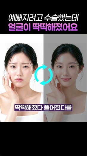 안면거상 후 얼굴이 딱딱해졌나요?