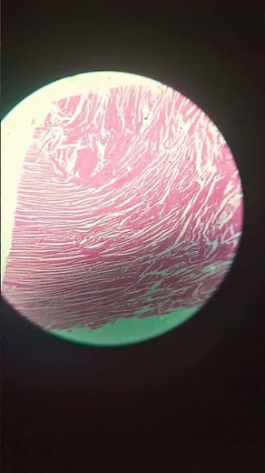Cardiac muscles under microscope #microscopy