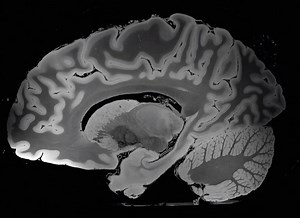2.7K views · 61 reactions | [易] Une incroyable imagerie médicale par résonance magnétique (IRM) d'une résolution de 100 microns d'un cerveau humain [易] Acquisition ex-vivo du cerveau d'une femme de 58 ans qui n'avait aucun antécédent de maladie neurologique et qui était décédée de causes non neurologiques. | Cours De Médecine | Facebook