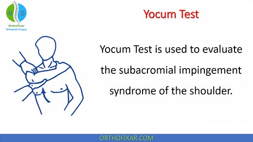 Yocum Test For Subacromial Impingement Syndrome Explained Easily | OrthoFixar