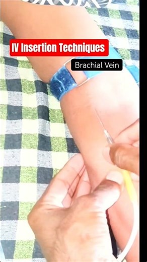 How Brachial Vein Insertion Techniques 💉 Fore Elbow Hand #shorts
