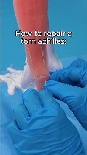 How to repair a torn achilles #doctor #surgeon