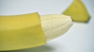 Anak yang Mengalami Fimosis Apakah Bisa Langsung Khitan? Ini Pemaparan Dokter Spesialis Anak - TribunHealth.com