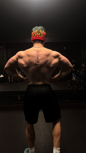 5 years lifting #gym #fitness #kyphosis #fitnessmotivation #fit | lifting