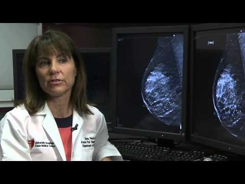 3D Mammography Finds Breast Cancer