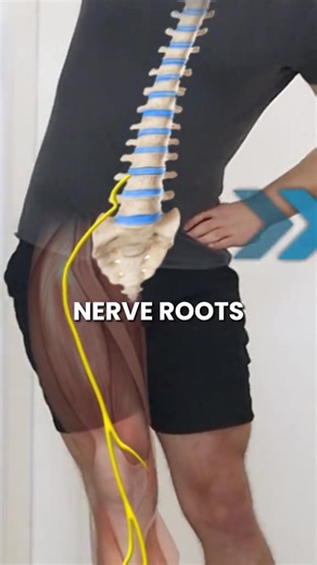 4.6K views · 46 reactions | Sciatica pain Relief Exercise #healthy #healthtips #sciatica | Spine Health Care | Facebook