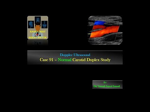 Ultrasound Case 91 -Normal Carotid Duplex Study