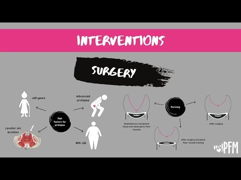 Interventions - Surgery