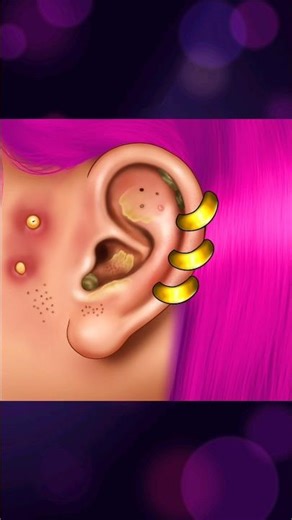 👂✨ ASMR Animation Ear Cleaning | Deep Ear Wax Removal 👂💆‍♀️ | Satisfying Relaxing #animation