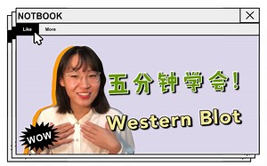 五分钟学会western blot的原理！值得收藏
