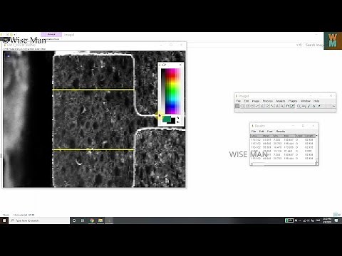HOW TO MEASURE DISTANCES IN SEM IMAGES USING IMAGEJ SOFTWARE