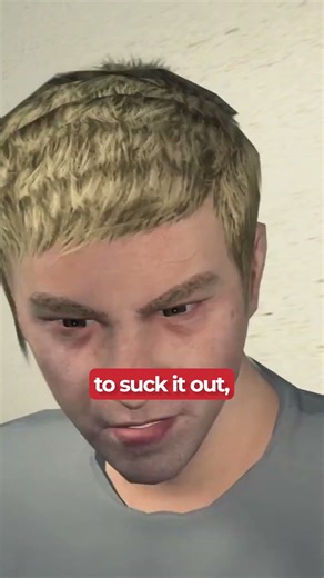 Man Finds Cockroach IN EAR!