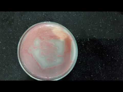 Qualitative detection of protease