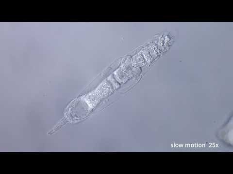 Ciliary movements of the rotifer Bryceella perpusilla