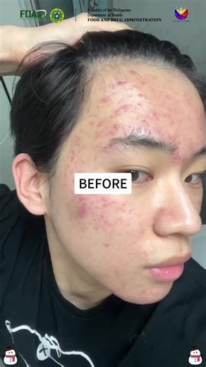 Achieve Healthy, Glowing Skin with JMCY Teashell Niacinamide Serum