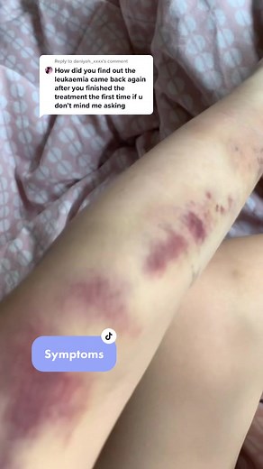 Understanding Petechia Rash: Symptoms of Leukemia Explained