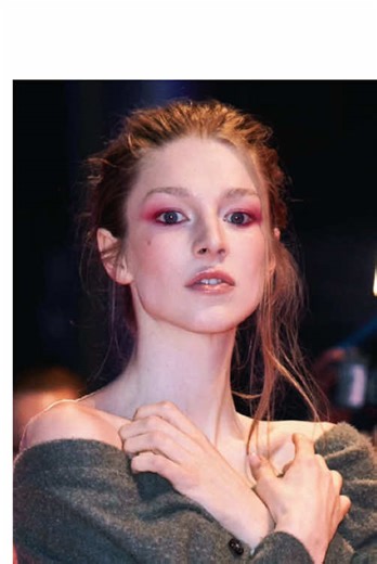 Experiencing Foreign Accent Syndrome: A Unique Journey