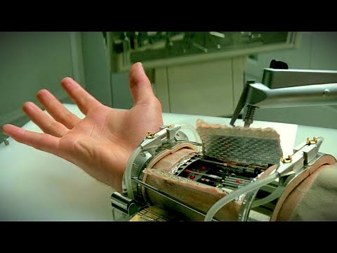 12 Most Incredible Exist Beyond Bionics: How The Future Of Prosthetics Is Redefining Humanity
