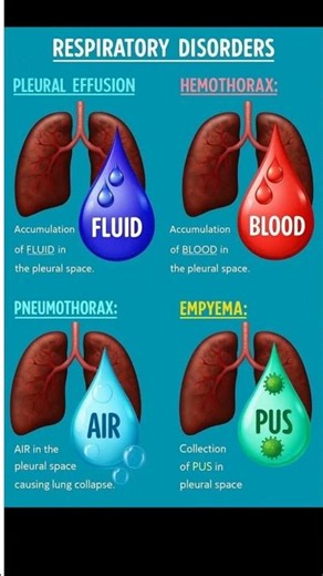 Respiratory Disorders: Types, Symptoms, and Management