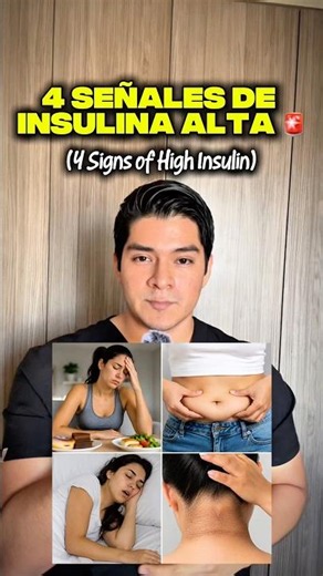 4 Signs of High Insulin 👨🏻‍⚕️🚨