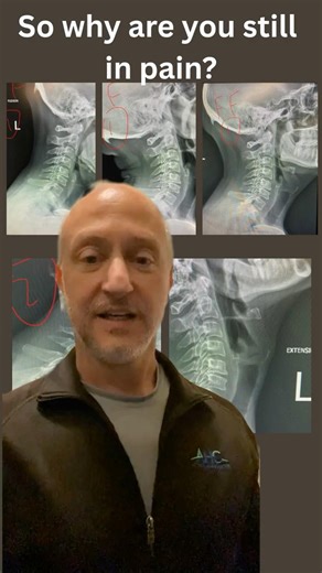 This Explains Your Pain...When Your X-Rays are Normal