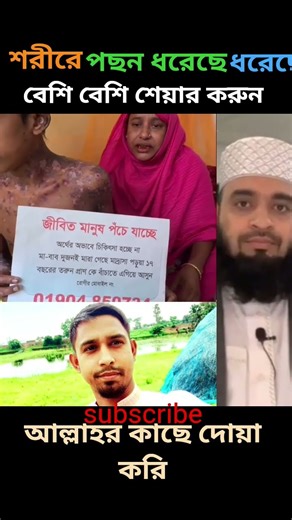 জীবিত মানুষের শরীরে পছন ধরেছে #mizanur_rahman_azhari