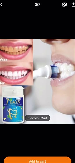Temu Teeth Whitening Review: Effective Results!
