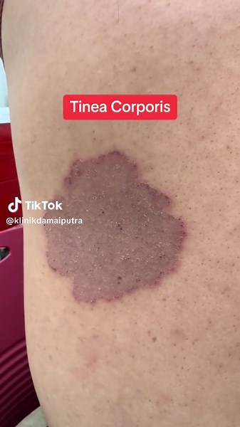 DrMazlanKlinikDamaiPutra on TikTok