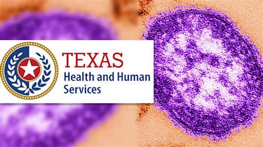 DSHS says there is no measles outbreak after cases reported in Kendall, Bandera counties