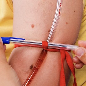 Everyday Emergencies? Try These Genius First Aid Tricks 🛑💡 | 5-Minute Crafts Teens