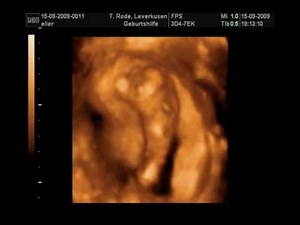 4D Scan of our daughter