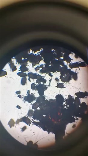 ITCHY EARS & HEAD SHAKING? 🐾 These are common signs your pet’s ears might be bothering them — and it can be really uncomfortable! 🚨 Watch out for: • Itchy ears or frequent scratching • Head shaking • Redness or swelling • Unpleasant odour If you notice any of these, book a vet visit! 👩‍⚕️👨‍⚕️ Your vet will take a look inside your pet’s ears, and sometimes even take a small sample to check under the microscope 🔬 — just like in the video! In this case, we found ear mites, tiny parasites that 