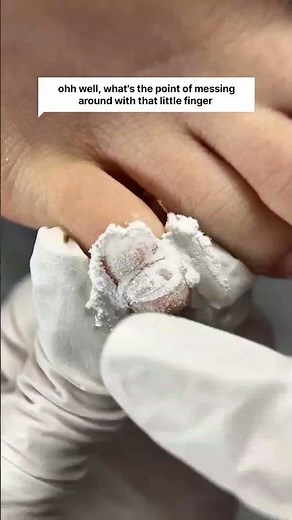 Pinky Toe Nail Easy Tutorial