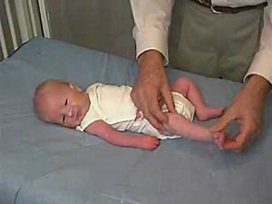 neurology exam: newborn-abnormal: Tone - Lower Extremity Tone