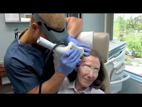 Facial Vein Treatment with CoolTouch Varia Laser