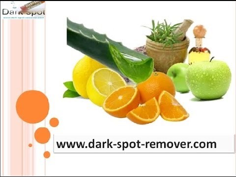 Homemade Recipe for dark Spot Remover - How to remove dark spots