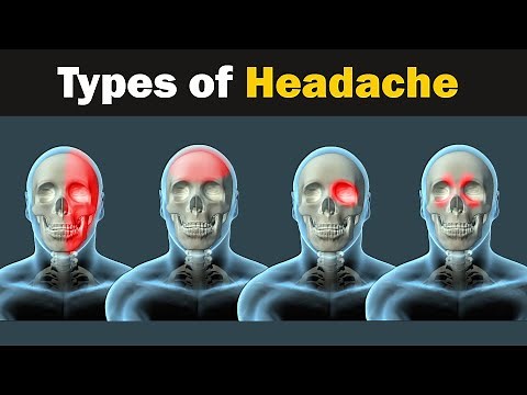 Headache - Types and causes | 3d Animation