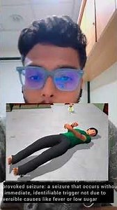 Seizure vs Convulsion vs Epilepsy – Know the Difference | Don’t Get Confused