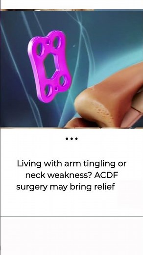 Arm Tingling & Neck Weakness? How ACDF Surgery Can Help