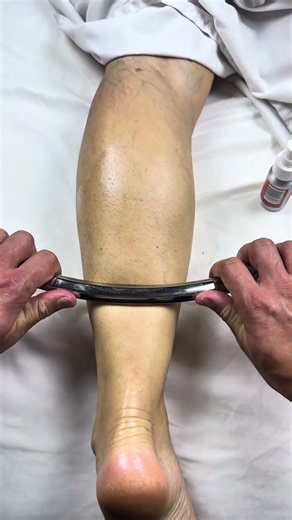 🚨 EXTREME CALF SPASMS? ACHILLES PAIN? FEELS LIKE YOUR FOOT IS ABOUT TO EXPLODE? 😱🔥