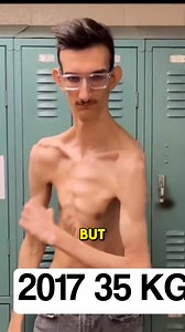 49K views · 157 reactions | You will be stunned when you see this man’s transformation—he is now a sexy macho. Watch the full video in comments  | Best Articles | Facebook