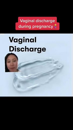 Vaginal Discharge During Pregnancy: Types, Colors, and What They Mean