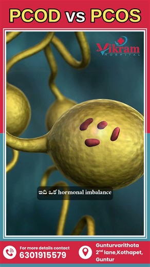 PCOD vs PCOS: What’s the Difference? || #pcod #pcos #healthtips #fitness #exercise #healthyeating