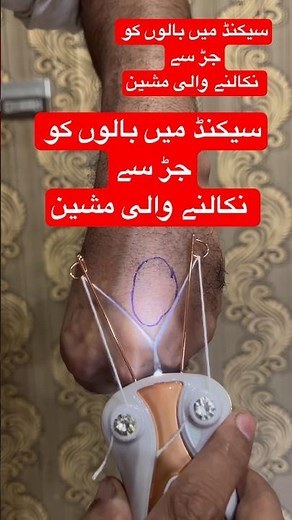 ✨ Unwanted Hair Removal at Home | Painless Threading Machine | Rechargeable Beauty Tool 💖