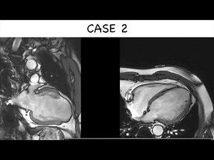 12. Case Series on viability assessment Dr Vimal Raj